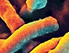 Ebola-Virus unterm Mikroskop